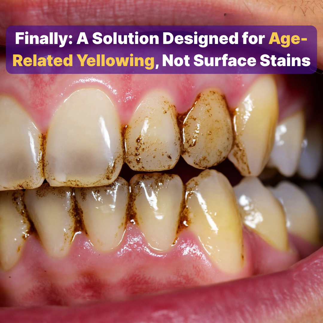 Jöro Purple Correction™ Strips