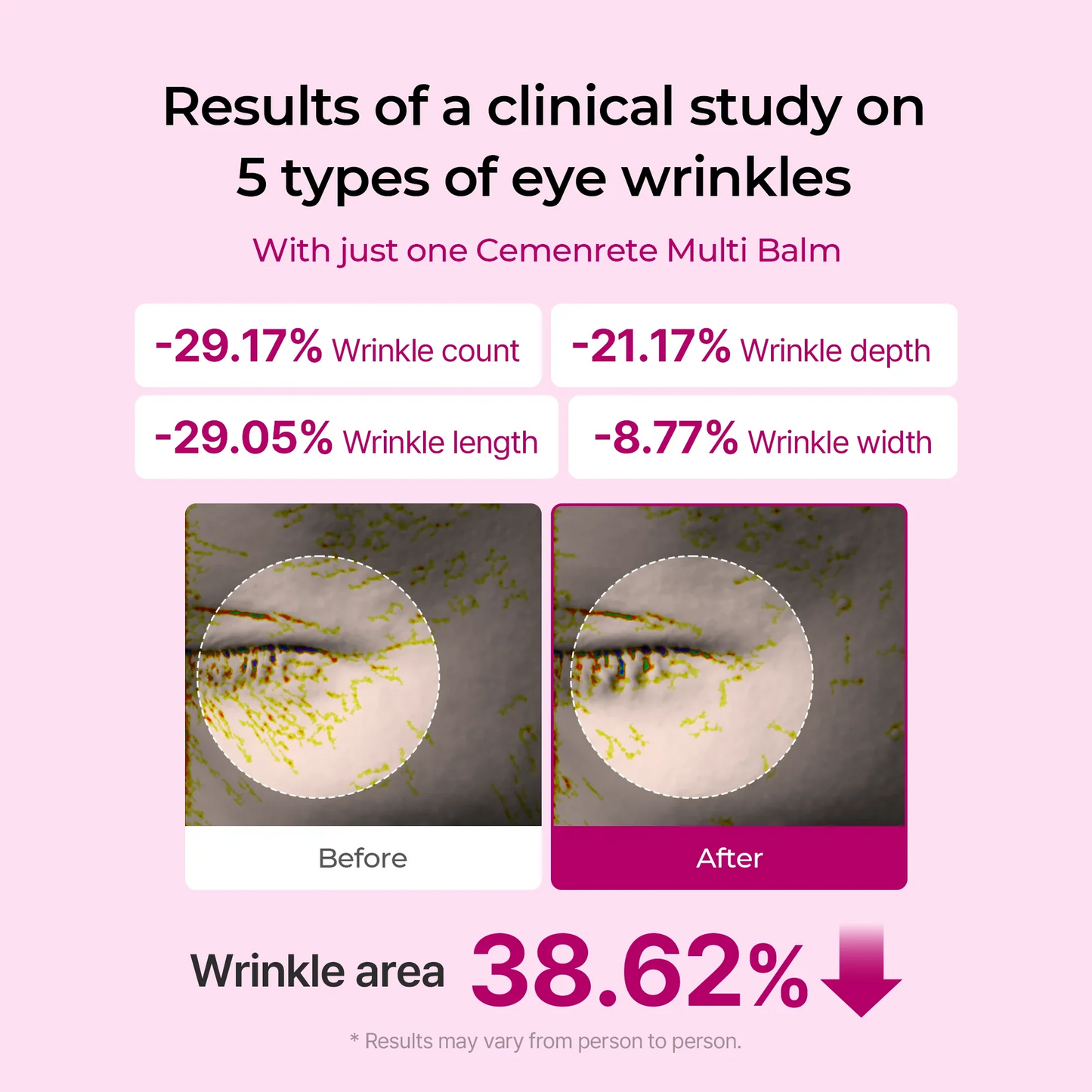 Firming Calcium Anti-Aging Balm for Wrinkles & Fine Lines